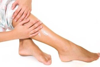 Varice treatment
