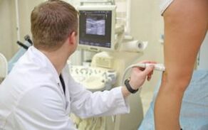 Methods of treatment of varicose veins on the legs in women